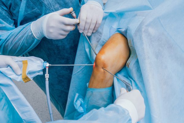 atroscopy